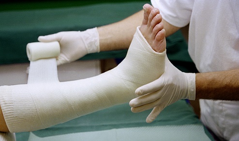 VIDEO: Caring for your cast, Tips to help your limb heal
